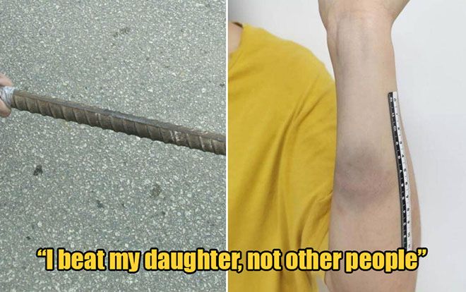 Qua 30 tuổi vẫn độc thân, cô gái bị mẹ ruột đánh thâm tím khắp người