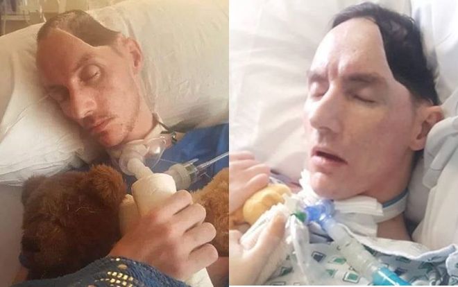 Người đàn ông bị tấn công tới mức nguy kịch nhưng thủ phạm chỉ nhận bản án nhẹ tới mức gây sốc