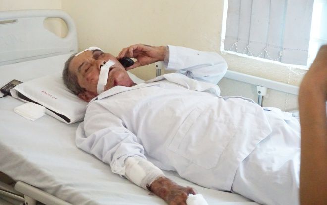 Tài xế xe ôm đánh cựu binh 80 tuổi rạn xương sườn, chấn thương nặng vì… khó chịu có thể bị phạt tù