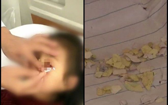 Bé gái bị bạn học nhét giấy vào mắt, thái độ của hiệu trưởng khiến ai nấy đều phẫn nộ