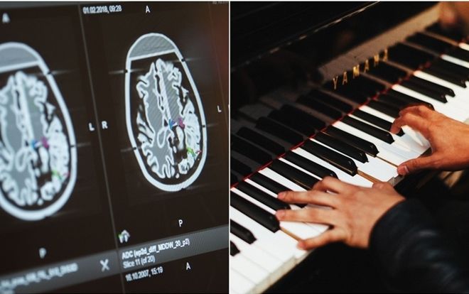 Bệnh nhân chơi piano trong lúc được mổ não