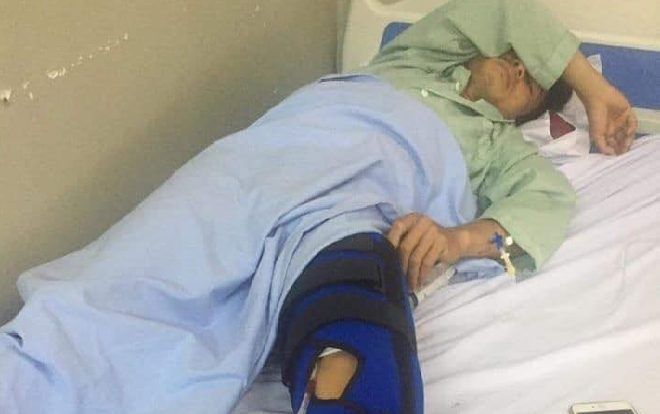 Đào chuyển cây mít trong vườn nhà, nam thanh niên bị ‘đạn lạc’ bay trúng đùi