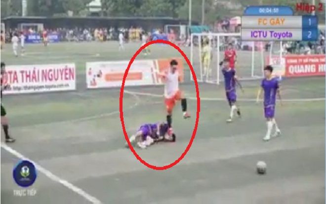 Cầu thủ bị đối thủ dẫm lên mặt trong trận bóng khiến co giật: ‘Tôi không chấp nhận hành động đó nhưng nghĩ vì tình người nên bỏ qua’
