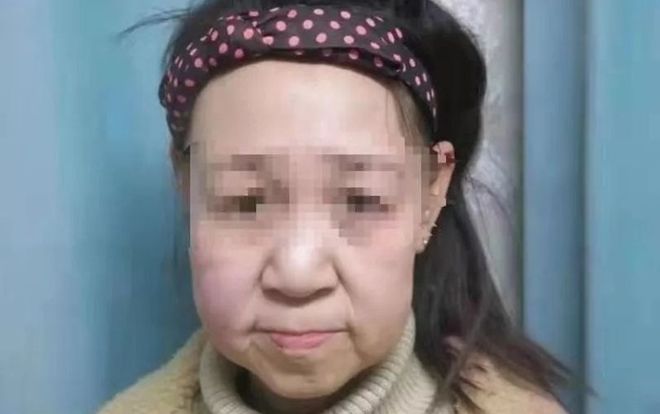 Thiếu nữ 15 tuổi bị gọi là 'quái vật' vì gương mặt như bà lão 60