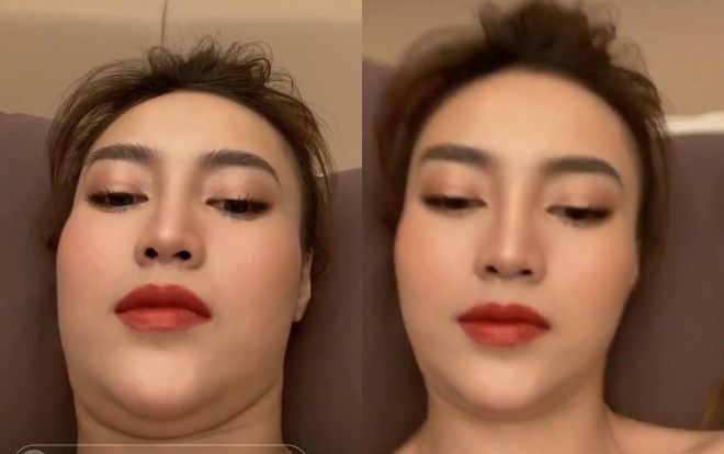 Ninh Dương Lan Ngọc khiến fan 'hú hồn' khi tự khoe ảnh cằm nọng và gương mặt béo múp