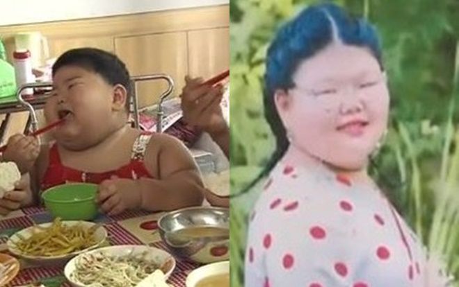Lúc 2 tuổi 'ăn như thuồng luồng' nặng tới 43 kg, cô gái khiến mọi người bất ngờ vì vóc dáng hiện tại