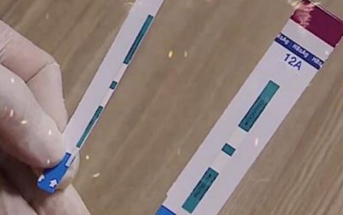 Vụ nhân viên bệnh viện Xanh Pôn tự ý cắt que thử nhanh HIV trước khi làm xét nghiệm: Có thể bị truy tố trách nhiệm hình sự