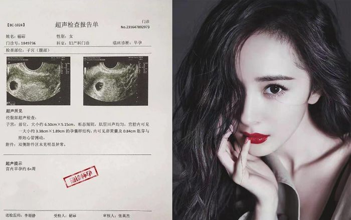 Mới lộ ảnh vào khách sạn với trai trẻ, Dương Mịch liền dính tin đồn mang thai?