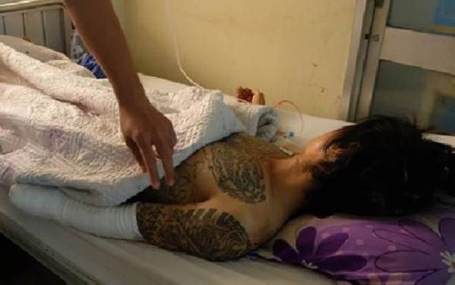 Nam thanh niên bất ngờ bị 2 đối tượng lạ mặt chém đứt lìa tay