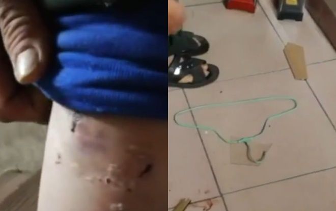 Người đàn ông khuyết tật tố bị vợ bạo hành trong nhiều năm và phản ứng gay gắt của cộng đồng mạng