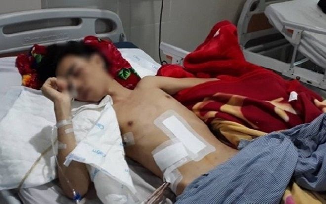 Xảy ra mâu thuẫn, nam sinh lớp 12 gọi người đến đâm bạn cùng trường nguy kịch