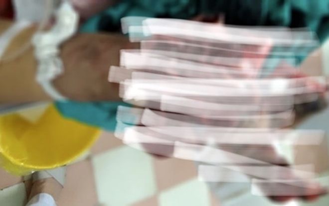 Mua thuốc nổ học chế pháo trên YouTube, nam sinh 15 tuổi bị dập nát tay