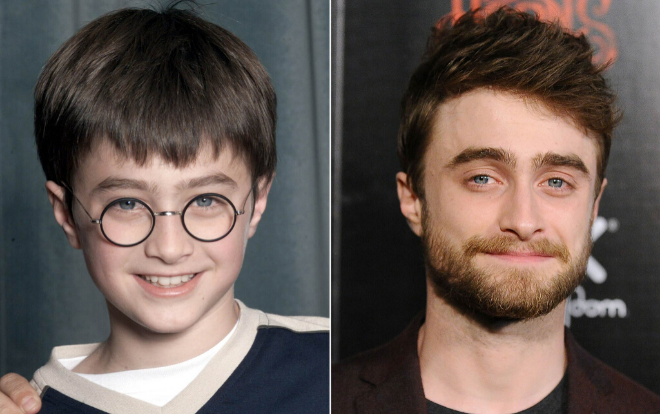 Hàng râu dài rậm của Daniel Radcliffe khiến người đi đường nhận nhầm là dân vô gia cư, cho 5 đô mua cà phê