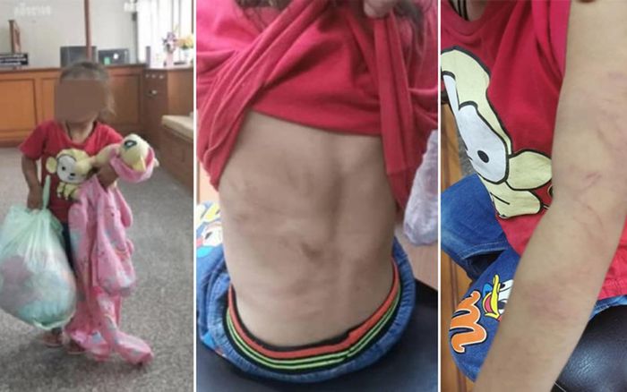 Mẹ bỏ con gái 2 tuổi mình đầy vết sẹo và bầm tím trước cửa trung tâm phúc lợi vì lý do xót xa