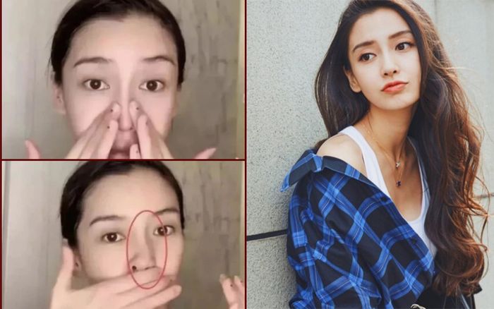 Angelababy bị lộ di chứng thẩm mỹ khi mũi bị vẹo lúc livestream?