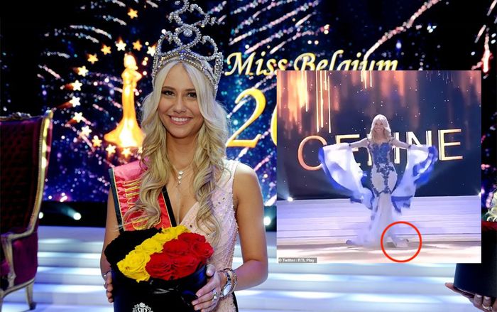 Tân Hoa hậu Bỉ gặp sự cố rơi áo ngực trên sân khấu khiến khán giả phì cười