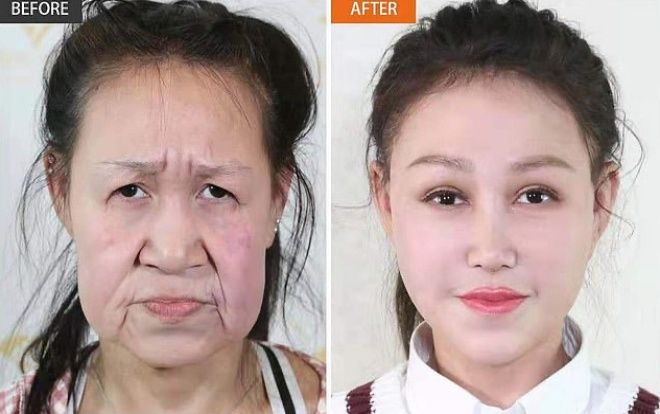 Thiếu nữ 15 tuổi mang gương mặt bà lão 'lột xác' đến ngỡ ngàng