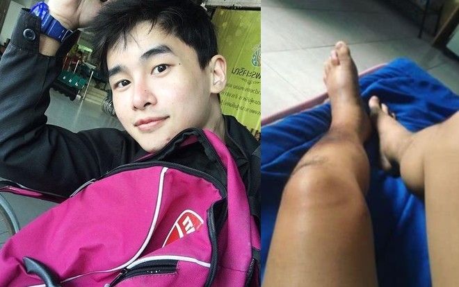 Nam diễn viên Thái Lan qua đời do ung thư da, luôn giữ thái độ lạc quan khi chiến đấu với căn bệnh quái ác