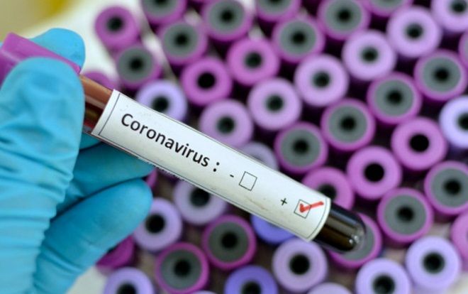 Bệnh nhân thứ 9 tại Việt Nam nhiễm virus corona