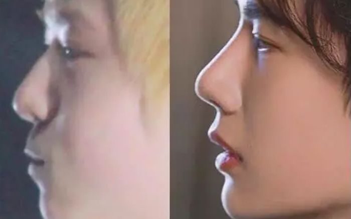 Hình ảnh quá khứ 'một trời một vực' khiến Vương Nhất Bác bị nghi ngờ phẫu thuật thẩm mỹ