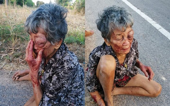 Cơ thể dày đặc vết thương của cụ bị cháu trai nghiện rượu bạo hành thậm tệ