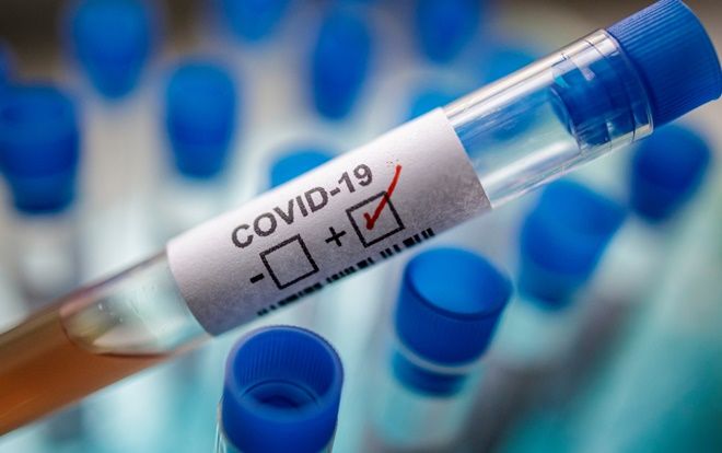 Ca mắc COVID-19 thứ 49 là người Anh, tiếp xúc gần với bệnh nhân số 30