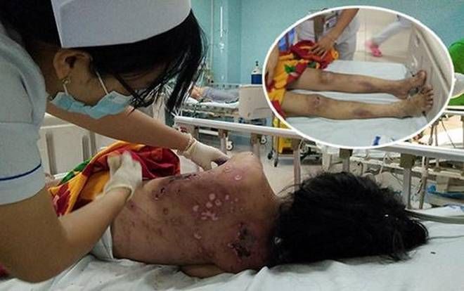 Bắt khẩn cấp chủ quán cà phê chích điện, đánh nhân viên