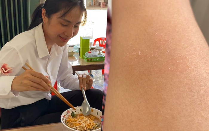 Sau hình ảnh ăn mì gây xúc động, Thủy Tiên khoe làn da bong tróc vì nắng miền Tây