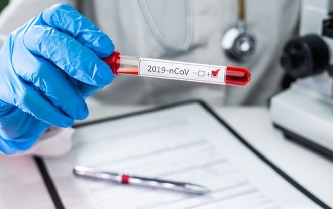 Ca nhiễm COVID-19 thứ 92 tại Việt Nam là du học sinh Pháp