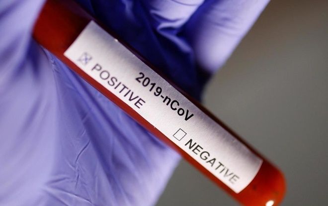 Công bố thêm 3 ca nhiễm COVID-19, bệnh nhân thứ 116 là bác sĩ Bệnh viện Bệnh nhiệt đới