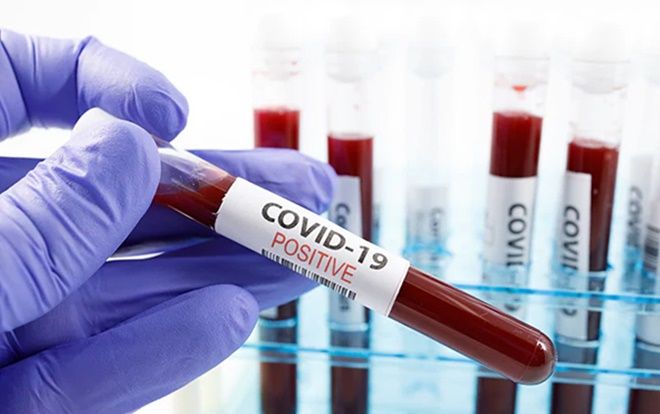 Thêm 3 ca COVID-19 ở TP HCM, trong đó có một người tiếp xúc với phi công Vietnam Airlines tại quán bar