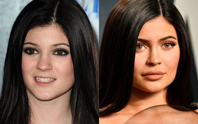 17 người nổi tiếng đổi dáng lông mày, đổi luôn cả vận mệnh