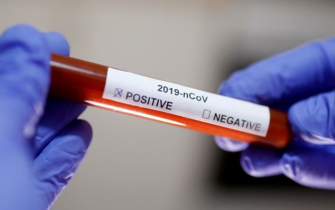 Thêm 5 ca nhiễm COVID-19, nâng tổng số người mắc lên 153: Có chị gái nhân viên quán Bar Buddha cùng 2 người đi nhiều nơi, tiếp xúc nhiều người