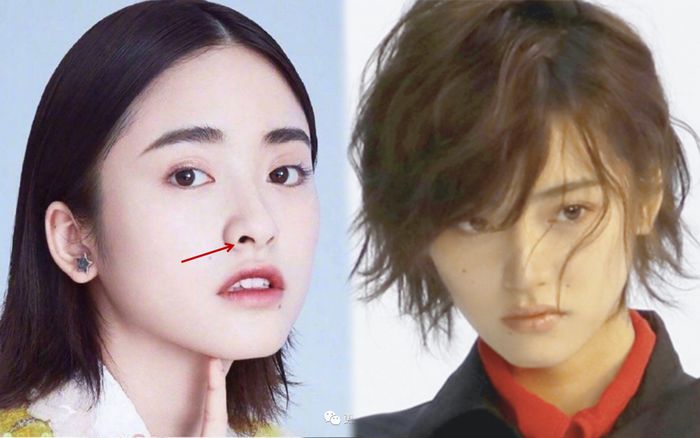 Tranh thủ thời gian ở ẩn tránh dịch, Thẩm Nguyệt đụng dao kéo, chỉnh mũi?