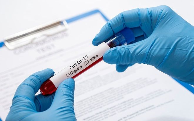 Cập nhật tình hình dịch COVID-19 ngày 5/4: Việt Nam có 3.154 trường hợp nghi nhiễm đang cách ly theo dõi