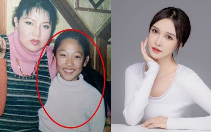 Hotgirl đình đám gây 'sốc' khi tiết lộ được mẹ chi 13 tỷ để phẫu thuật thẩm mỹ 300 lần từ năm 14 tuổi