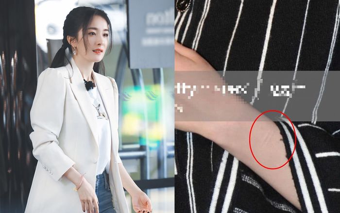 Dân mạng đau lòng khi thấy những vết sẹo như dao cứa trên cánh tay của Dương Mịch