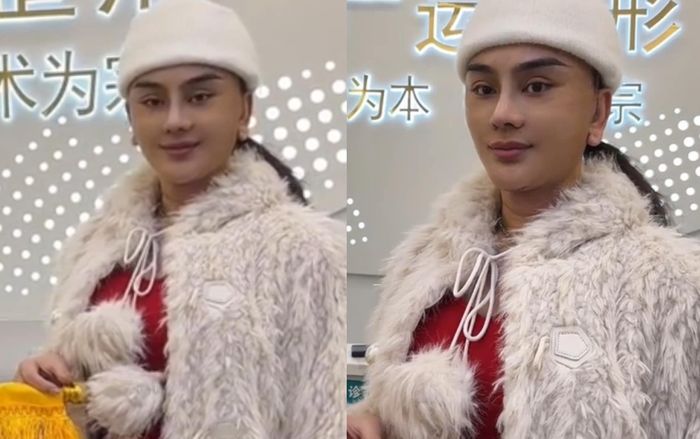 Lâm Khánh Chi 'photoshop' ảnh đi phẫu thuật: Nhan sắc thật khác xa trên mạng