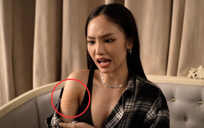 Miu Lê bị thương khi đóng phim khiến khán giả xót xa