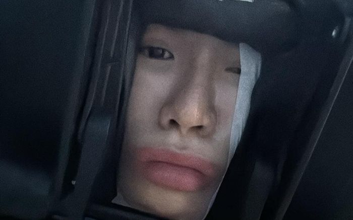 Minh Tú phải huỷ show vì sức khỏe, tiết lộ đang tập vật lý trị liệu khiến fan lo lắng