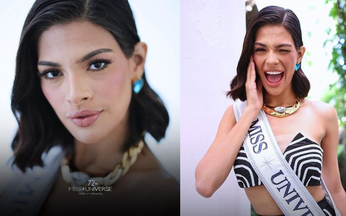 Tân Hoa hậu Hoàn vũ lộ vẻ ngoài kém sức sống, 'dừ' hơn tuổi thật ở loạt ảnh đầu tiên sau đăng quang