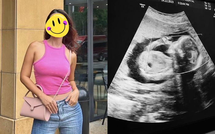 Một siêu mẫu đình đám công khai phiếu siêu âm thai, đặt nhiều tâm tư vào em bé trong bụng