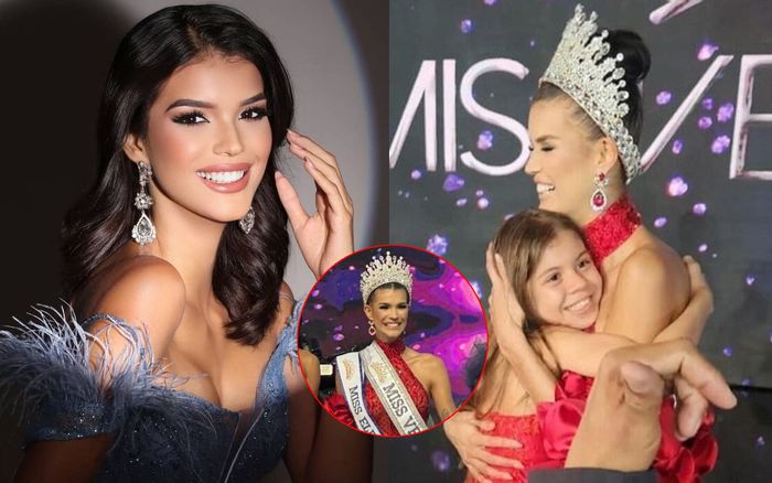 Người đẹp có con lúc 16 tuổi đăng quang Hoa hậu Venezuela, bị 'điểm trừ' khó đỡ khi đội vương miện
