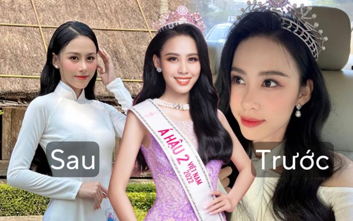 Nối gót Thanh Thủy, Á hậu 2 Hoa hậu Việt Nam để lộ chiếc mũi 'trùng tu'