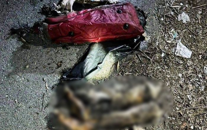 Công an thông tin bất ngờ về cặp tay chân bị đốt ở Bình Dương