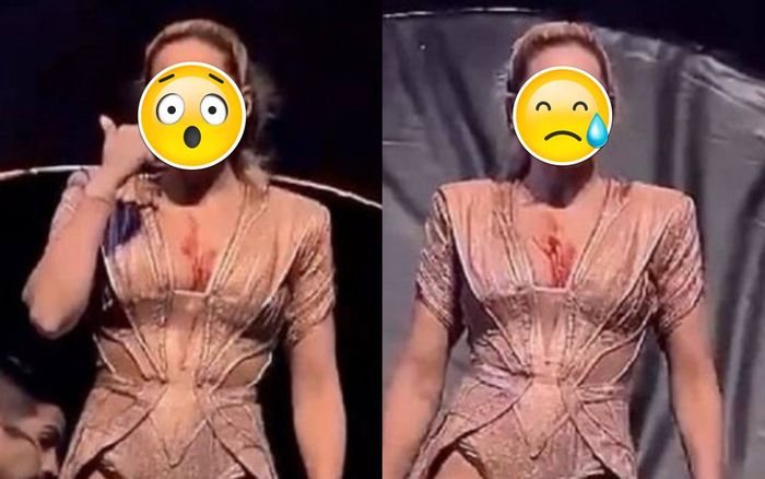 Nữ ca sĩ bị rạch mặt, ngã đập đầu trên sân khấu khi đang biểu diễn