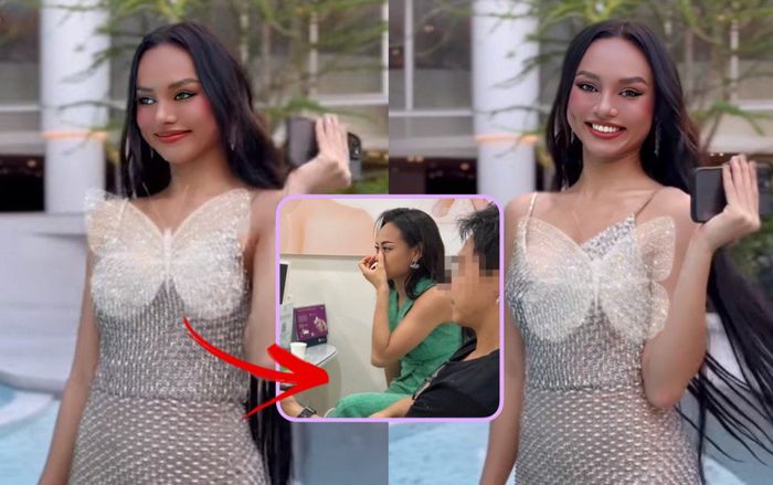 Lộ ảnh Á hậu Mai Ngô 'nâng cấp' nhan sắc tại cơ sở thẩm mỹ, dân mạng soi ngay chiếc mũi mới