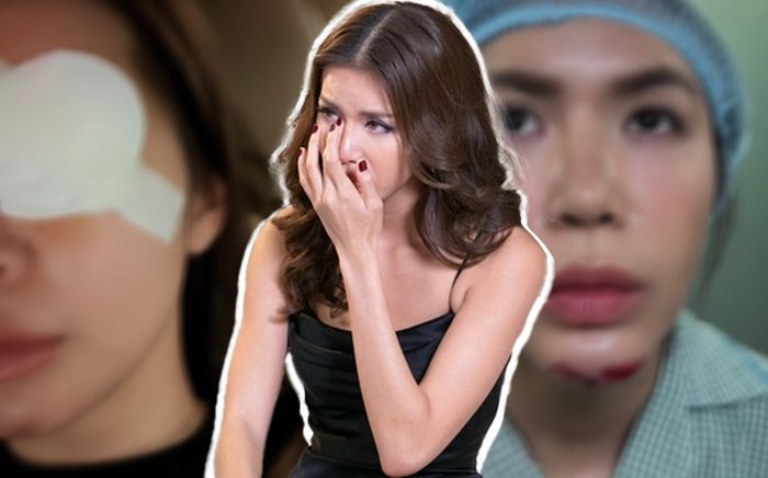 Minh Tú tiếp tục gây lo lắng hậu bị tai nạn phải khâu hơn 10 mũi: Hết cằm lại tới mắt!