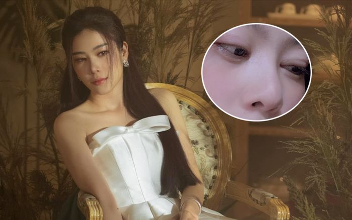 Nam Em gây lo lắng với gương mặt hốc hác, mắt sưng vù: Chuyện gì đang xảy ra?