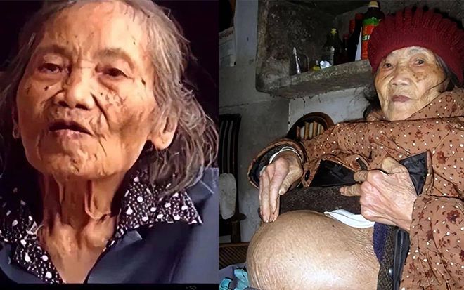 Cụ bà 91 tuổi đi khám phát hiện có thai, bí mật giấu 60 năm cuối cùng cũng lộ